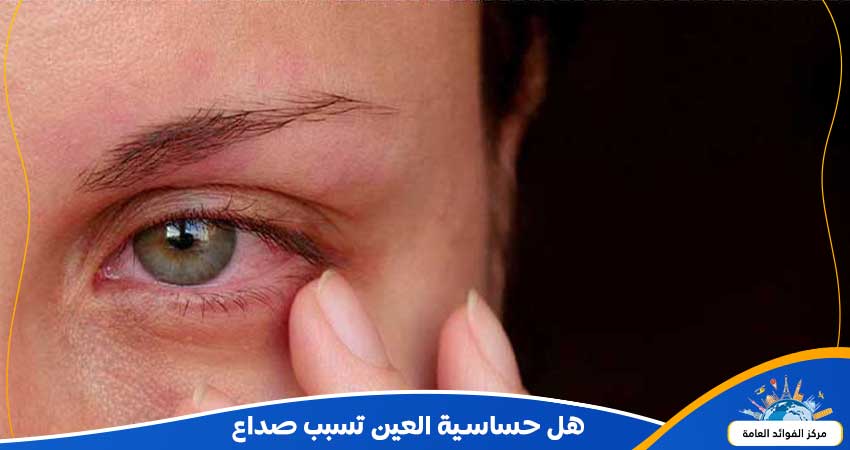 هل حساسية العين تسبب صداع