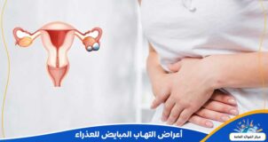 أعراض التهاب المبايض للعذراء