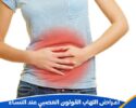 اعراض التهاب القولون العصبي عند النساء